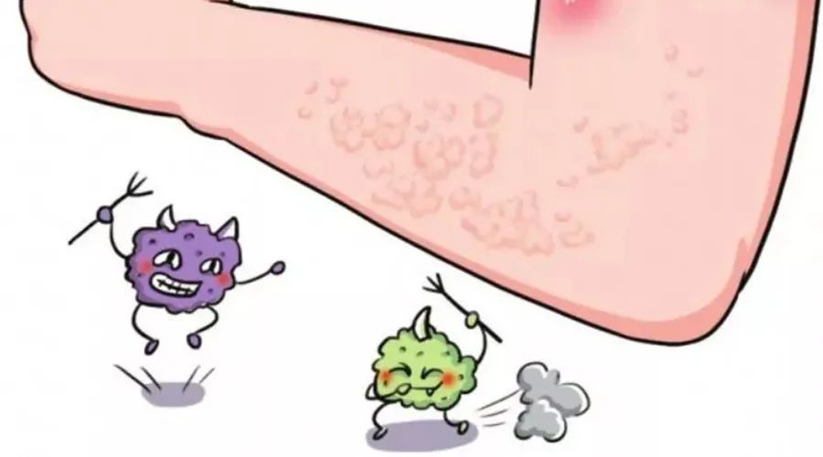 【科学就医我行动】秋季易被荨麻疹折磨，缓解症状的应急宝贝是它！