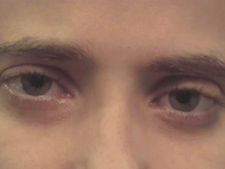 周期交替性眼震参考资料:[1] eye movement disorders. 1st ed.