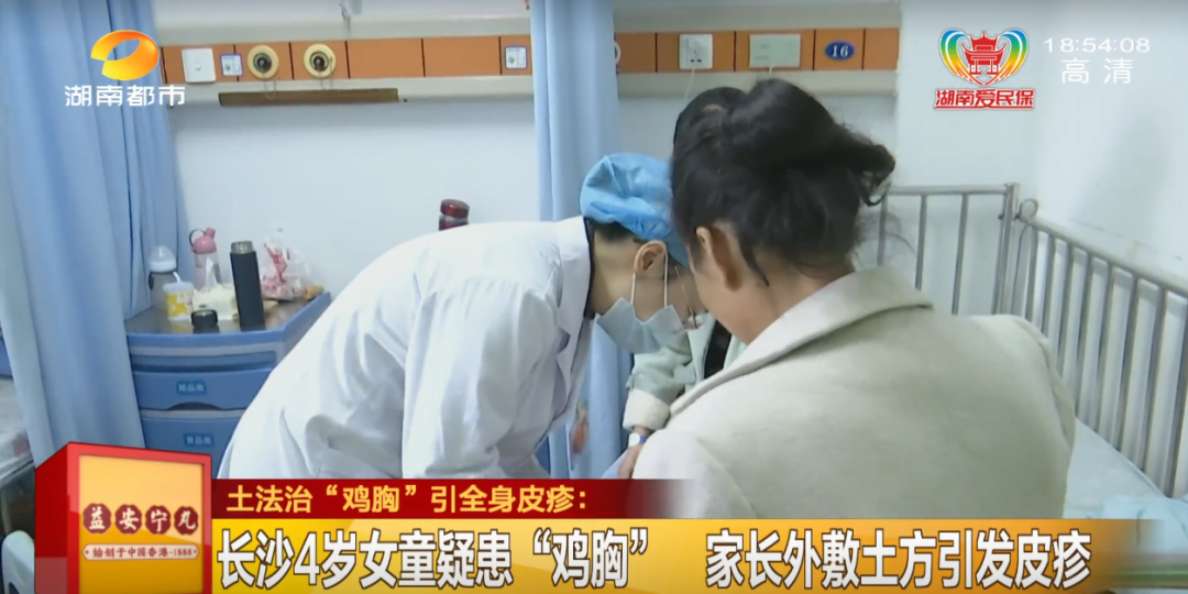 长沙4岁女童疑患鸡胸没想到家长这个做法却