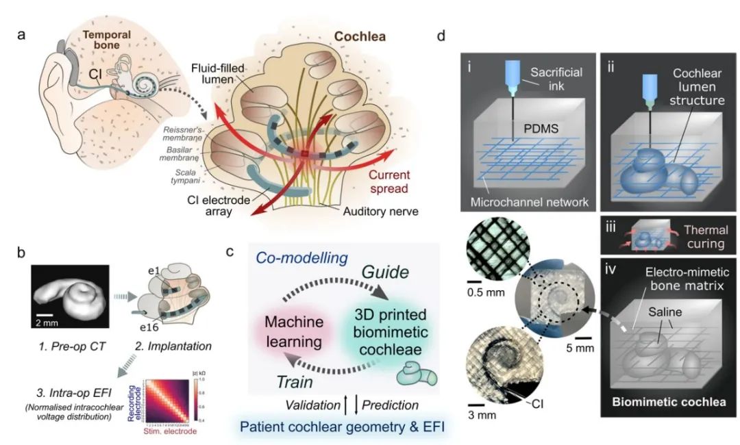 请问奥地利人工耳蜗电池在哪里可以买?