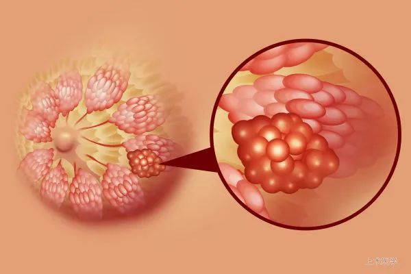 二,乳腺癌4.戒烟,避免其对消化道的长期毒性和炎性刺激.3.
