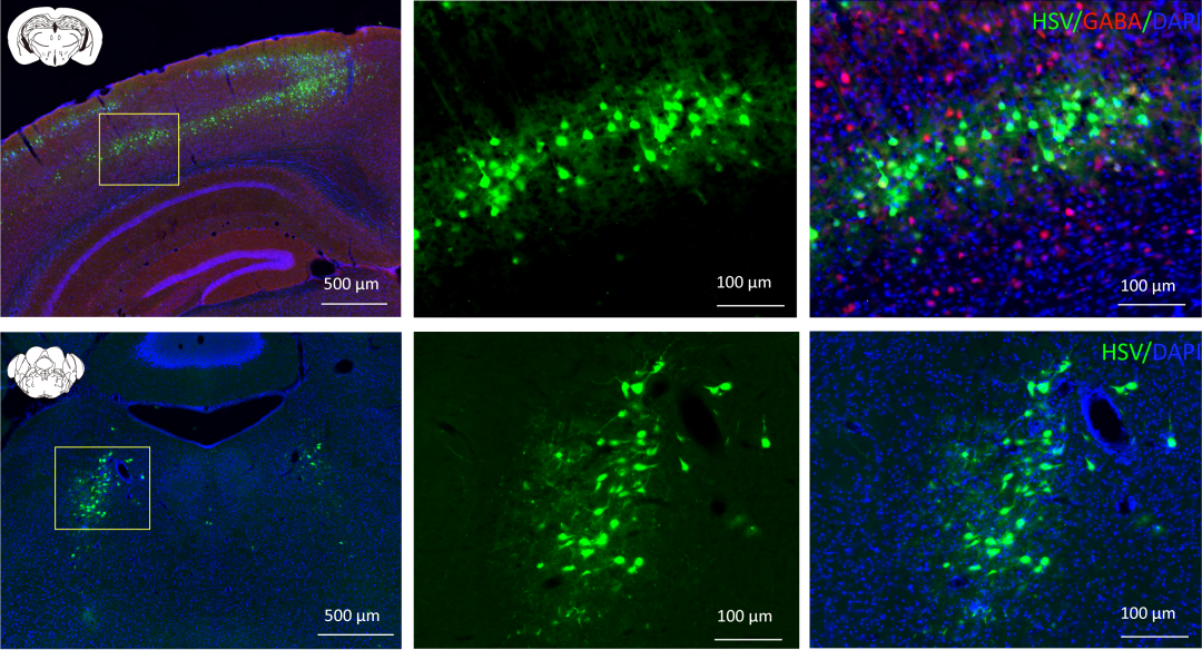 海马ca1区;产品:吉凯慢病毒[2]检测时间:注射后3天;观察部位:小鼠m1区