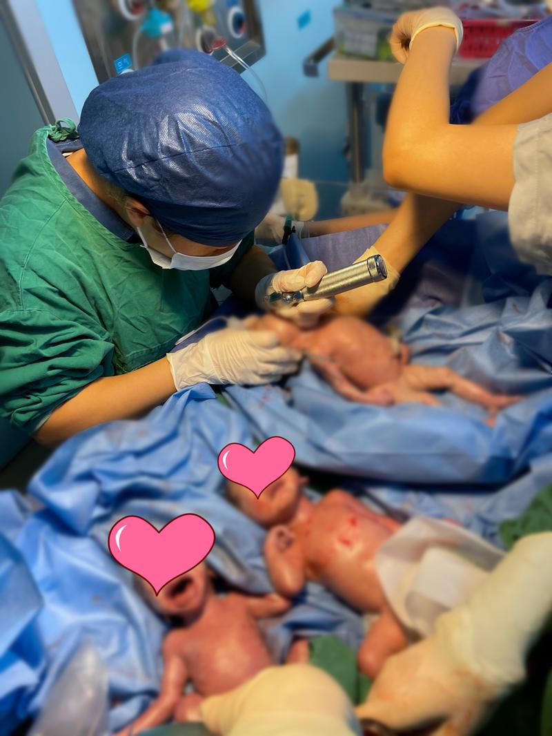 一龙双凤这位妈妈一口气完成三胎任务龙岗区人民医院成功接生三胞胎