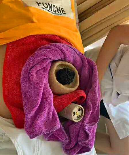 中医儿科李波:什么是脐灸?脐灸有作用?脐灸的注意事项有哪些?__财经头