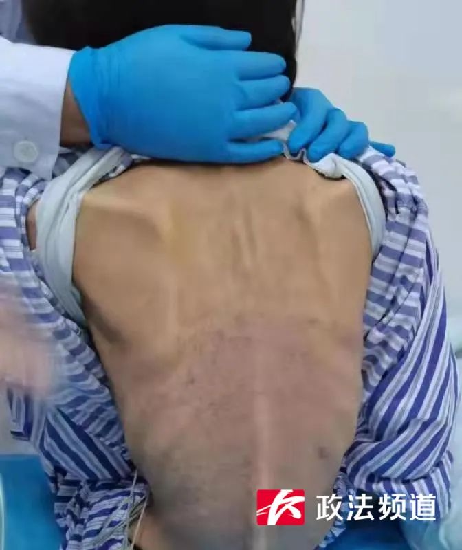 长沙00后女大学生疯狂减重只剩60斤后晕厥，住院当天小便失禁了...休闲区蓝鸢梦想 - Www.slyday.coM