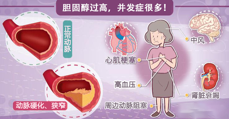 胆固醇高不敢吃鸡蛋一次性了解清楚