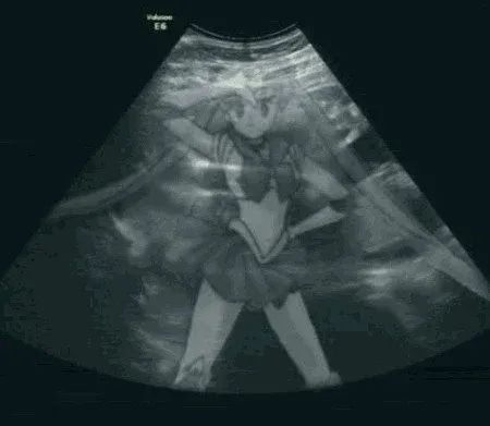 瞬间发飙！上海地铁两女子上演全武行，一人还是孕妇！休闲区蓝鸢梦想 - Www.slyday.coM