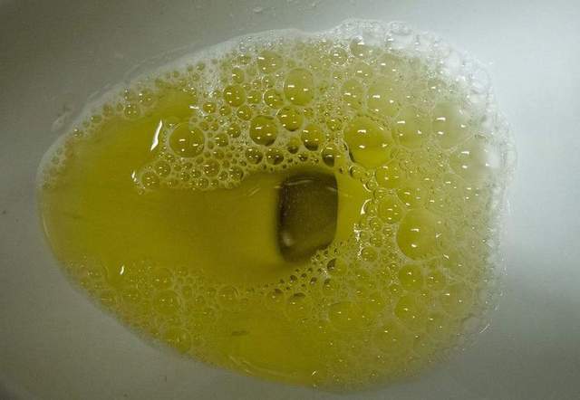 肝不好了，身体会偷偷告诉你，晨起有4个异常表现，要养肝了休闲区蓝鸢梦想 - Www.slyday.coM