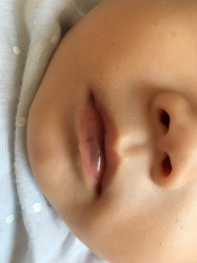 看看老中医的正确护理方法|宝宝|老中医|唇炎_新浪新闻