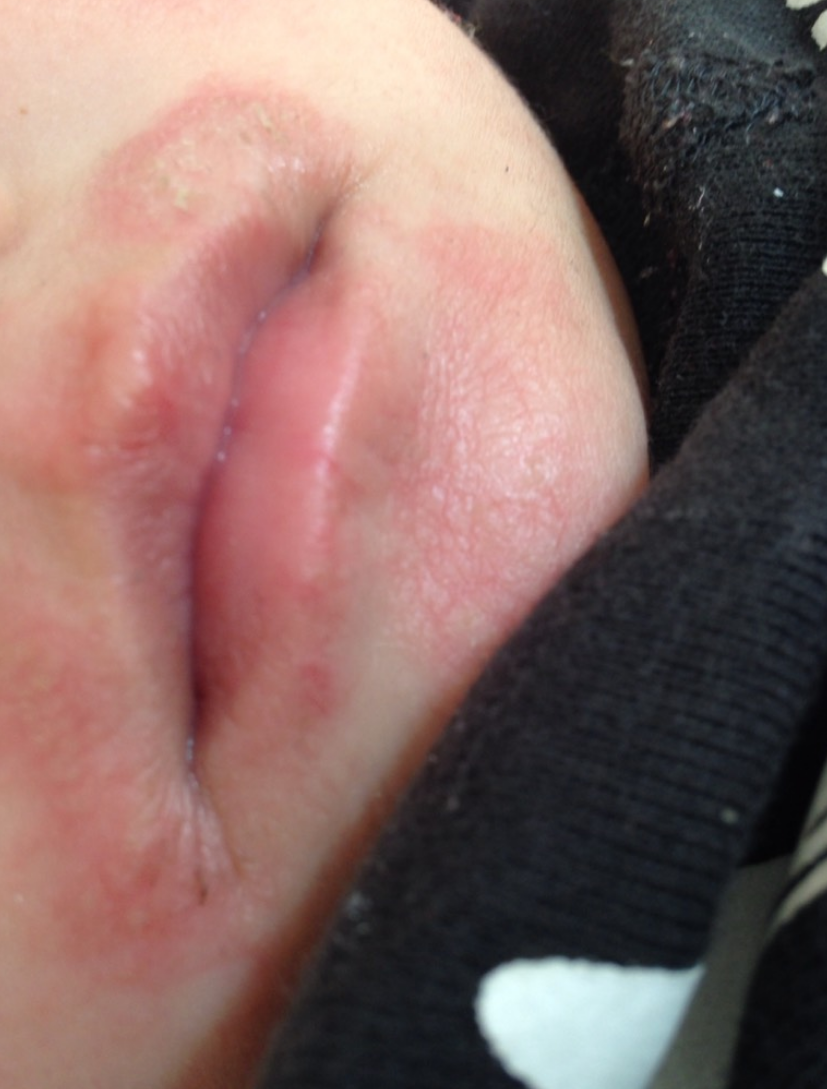 看看老中医的正确护理方法|宝宝|老中医|唇炎_新浪新闻