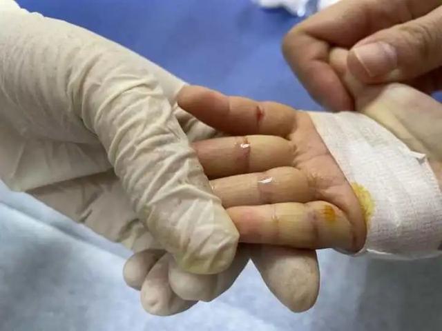 杭州2岁女童反复患肺炎，瘦成这副样子！爸爸说出一个“秘密”，妈妈绷不住了……休闲区蓝鸢梦想 - Www.slyday.coM