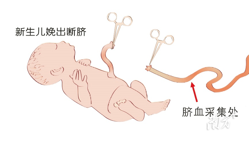 脐血只能在新生儿分娩断脐后立即从断离的连接胎盘的脐带脐静脉中采集
