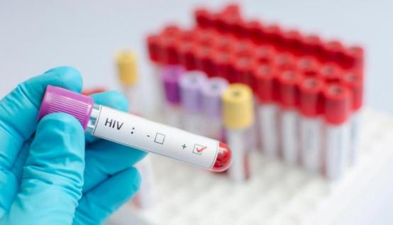 艾滋病也能自愈？全球已出现第二例休闲区蓝鸢梦想 - Www.slyday.coM
