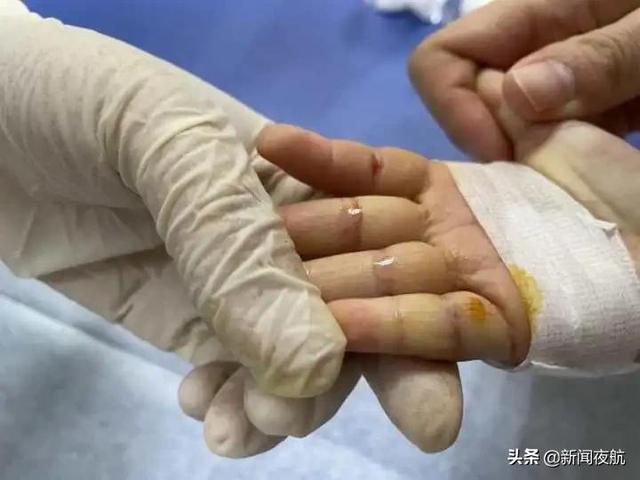 2岁女童反复患肺炎！爸爸说出一个“秘密”，让妈妈绷不住了……休闲区蓝鸢梦想 - Www.slyday.coM