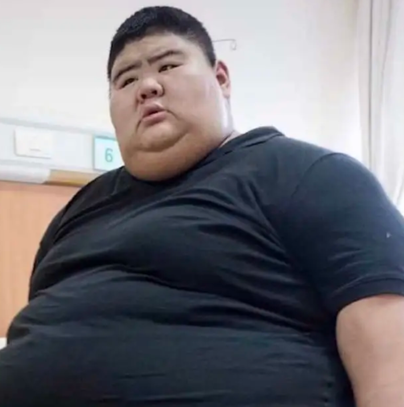 网红山东第一胖官宣结婚为娶妻暴瘦400多斤还曾切胃减肥