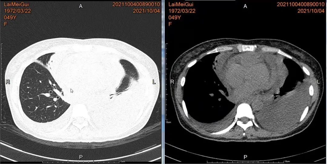 千万注意！厦门一女子长时间双下肢浮肿，一查竟是…休闲区蓝鸢梦想 - Www.slyday.coM