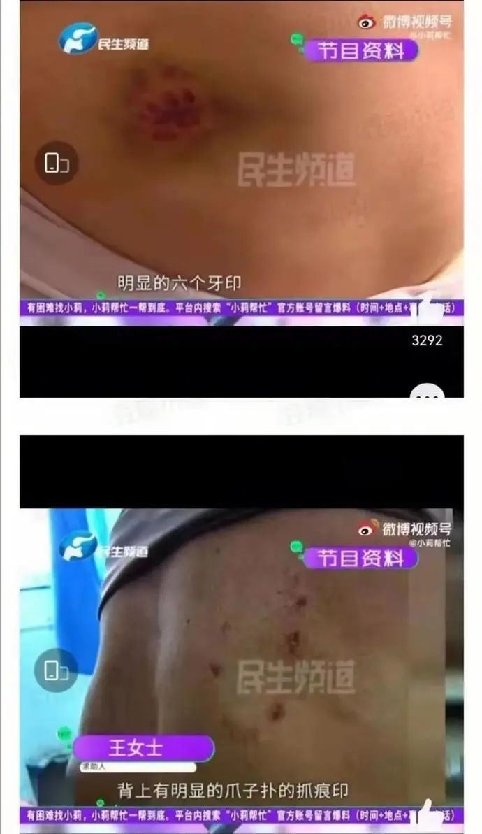 狗咬人不承认？央媒关注后，把女记者为难哭的狗主人想和解了休闲区蓝鸢梦想 - Www.slyday.coM