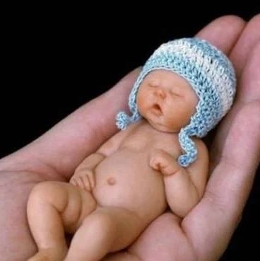 成功将一位特别的小患者平安送回父母的怀抱,她就是"手掌宝宝"小玥玥