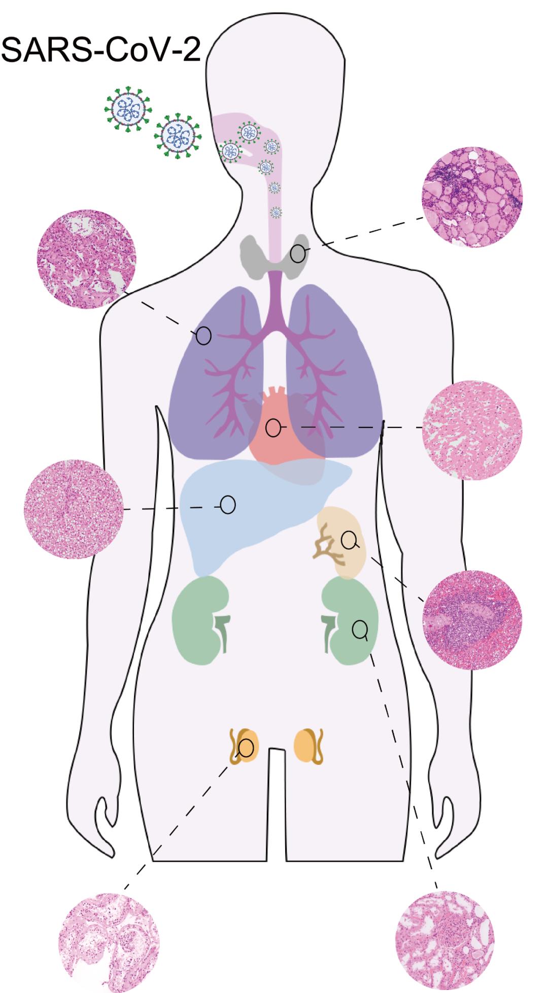 图片说明：新冠肺炎患者多器官样本采集和镜下病理学检查。