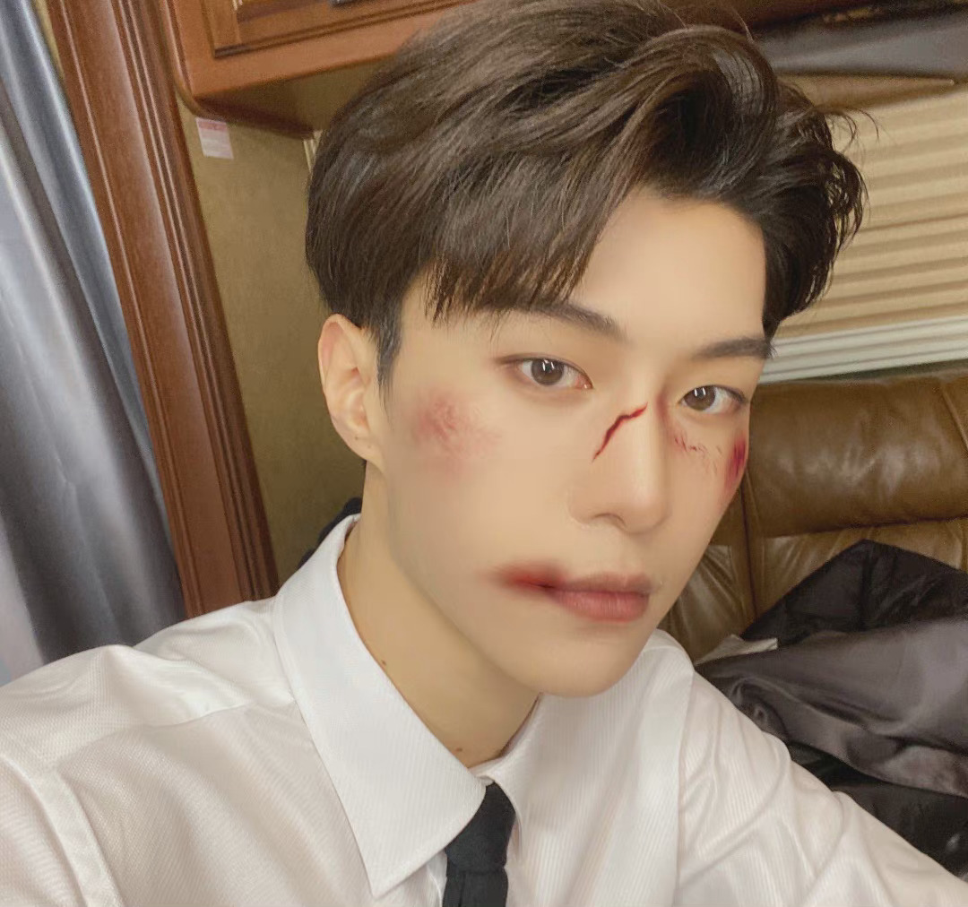 范丞丞在门锁中又受伤了咱就是说