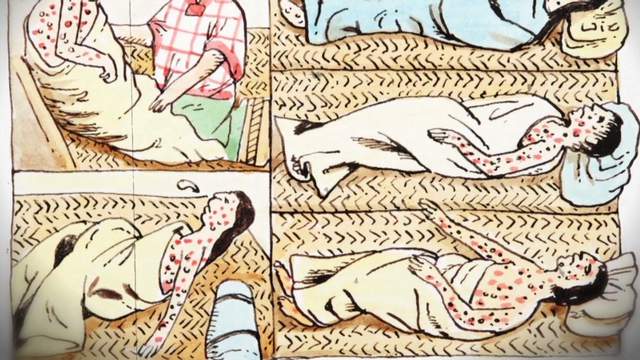 曾经夺走数亿人生命,天花病毒在美国被意外发现,会传播吗?休闲区蓝鸢梦想 - Www.slyday.coM 曾经夺走数亿人生命,天花病毒在美国被意外发现,会传播吗?休闲区蓝鸢梦想 - Www.slyday.coM