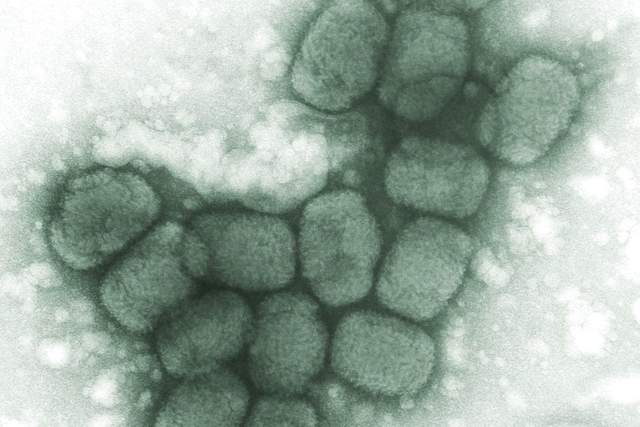 曾经夺走数亿人生命,天花病毒在美国被意外发现,会传播吗?休闲区蓝鸢梦想 - Www.slyday.coM 曾经夺走数亿人生命,天花病毒在美国被意外发现,会传播吗?休闲区蓝鸢梦想 - Www.slyday.coM