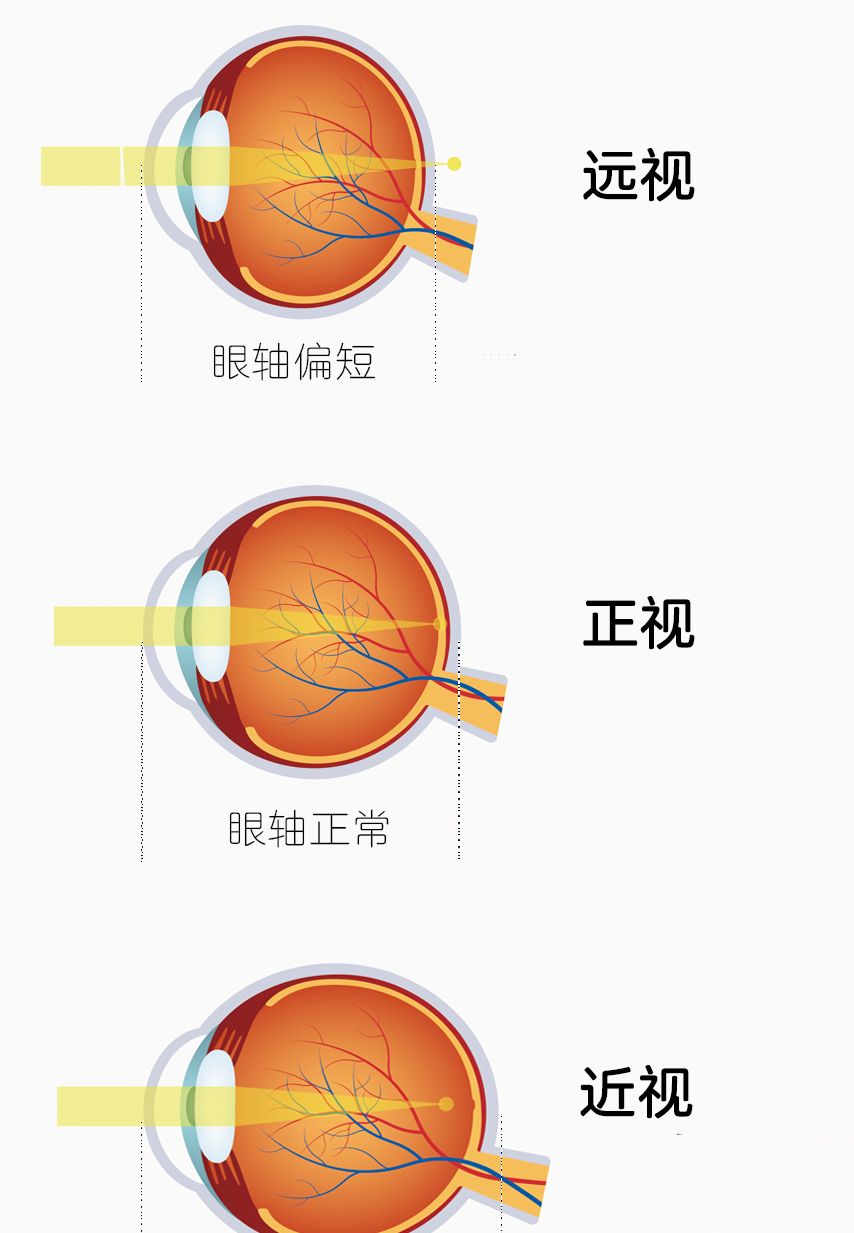 远视眼中的世界图片图片