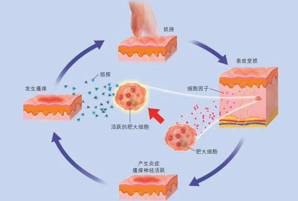 水杨酸产品运用原理