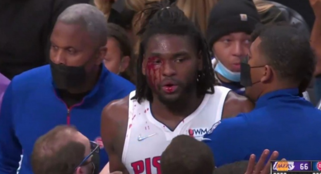 冲突！詹姆斯肘击活塞悍将，血流满面，生涯第二次直接被驱逐休闲区蓝鸢梦想 - Www.slyday.coM