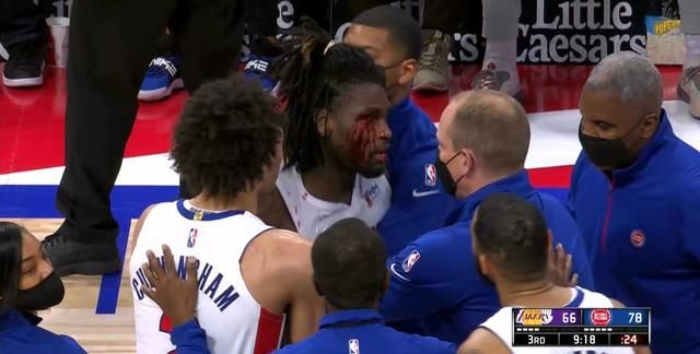 坏事变好事!詹姆斯肘击被驱逐,竟意外激起湖人的斗志休闲区蓝鸢梦想 - Www.slyday.coM 坏事变好事!詹姆斯肘击被驱逐,竟意外激起湖人的斗志休闲区蓝鸢梦想 - Www.slyday.coM