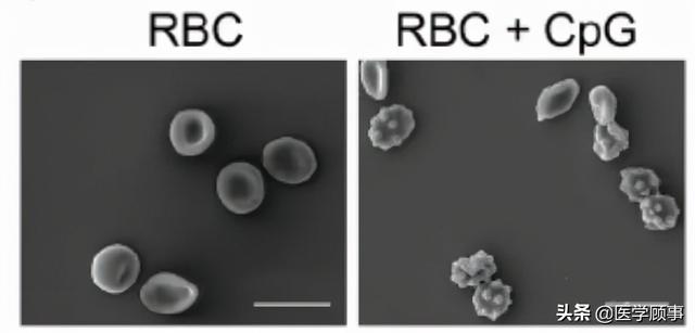 掃描電鏡下可以清楚地看到,表面結合dna後的紅細胞(右)形態出現鎬變