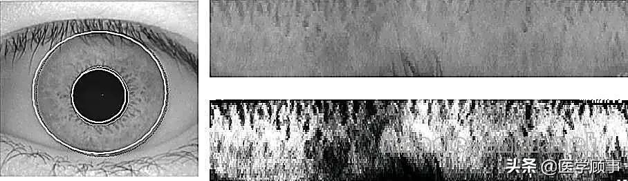 虹膜识别你究竟了解多少