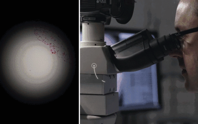 在先辈,现代医学以及各种精密仪器的长期观察,总结分析中,癌症的秘密