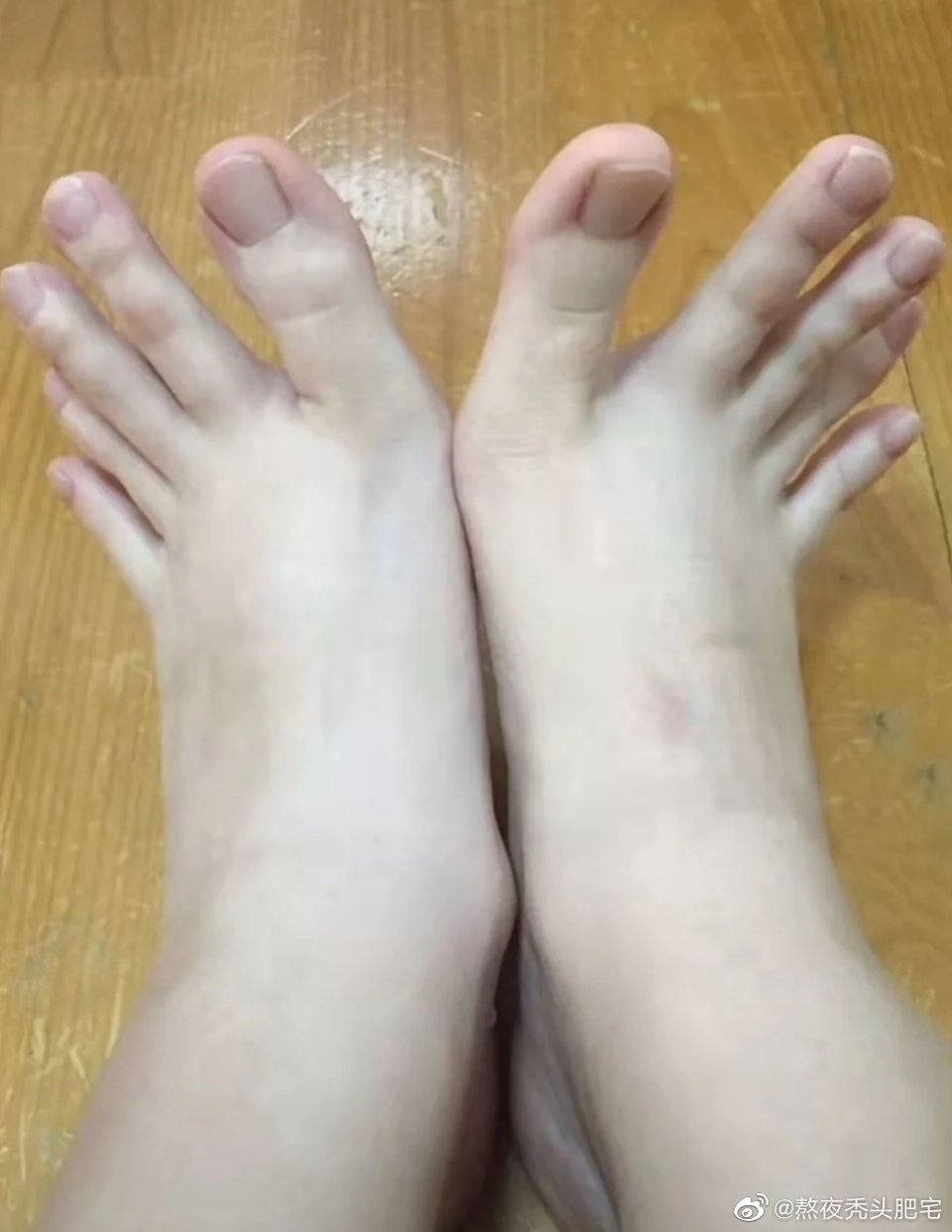 这么长的脚趾还真是头一次见