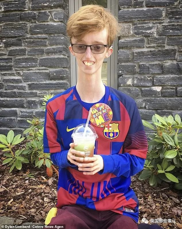 英国少年怎么吃都瘦得像竹竿存不下脂肪竟是患有六亿分之一几率的罕见