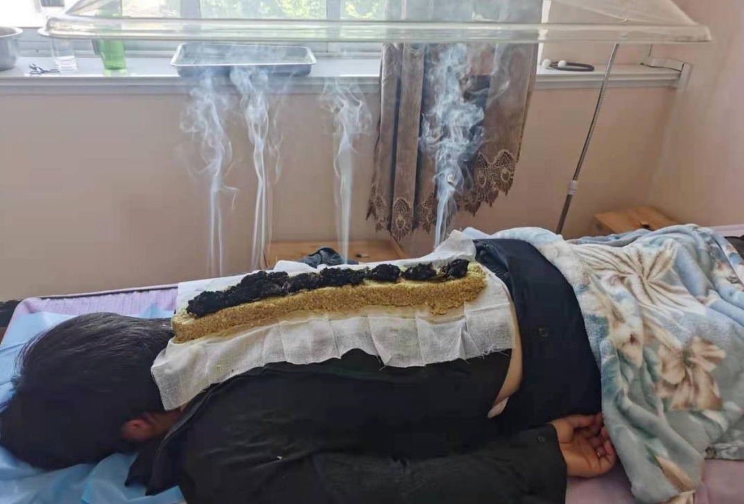 中医儿科杨晓什么是督灸督灸的适用范围操作方法和禁忌事项