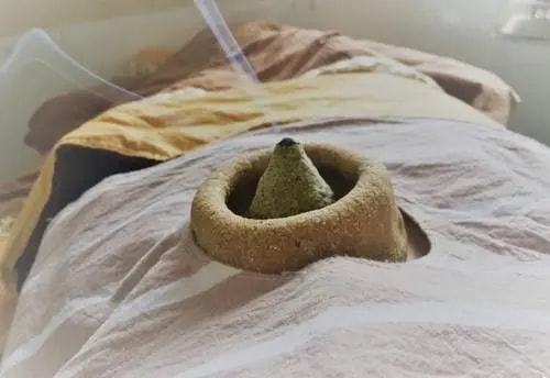 此时如果能对儿童的肚脐眼进行艾灸,可以清热利湿,促使发烧症状尽快