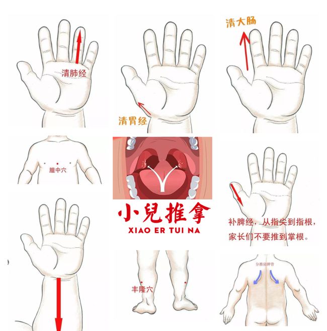 济南中医儿科杨晓小儿扁桃体炎反复发作危害大小儿推拿来调理
