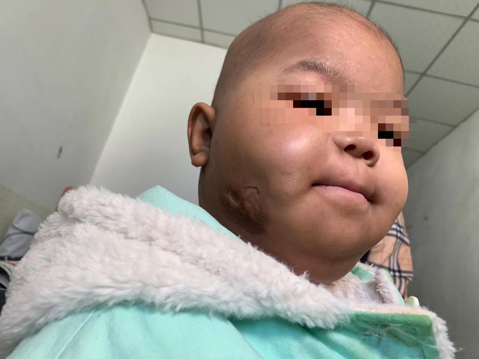 3岁女童患横纹肌肉瘤来京医治，化疗时安慰妈妈“不哭”休闲区蓝鸢梦想 - Www.slyday.coM