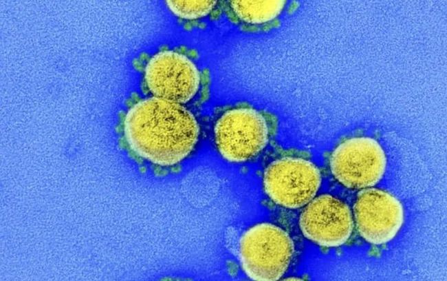 又有新型变异毒株！香港发现多例！钟南山发声！休闲区蓝鸢梦想 - Www.slyday.coM