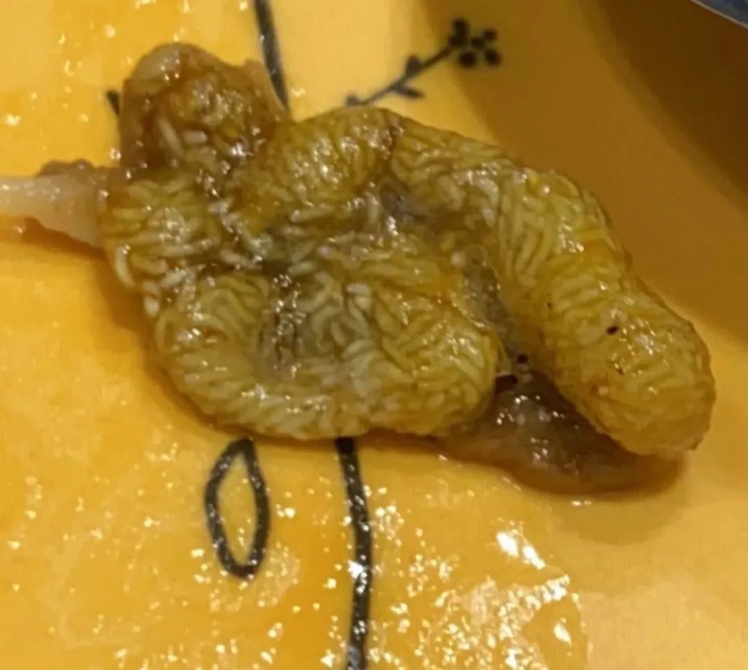 吃出好大一坨蛆?