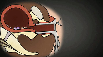 时时关注:城中村嫖妓不戴套少妇现象背后,隐藏着哪些不为人知的故事?
