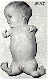 沙利度胺反应停事件是现代医学史上最大的灾难