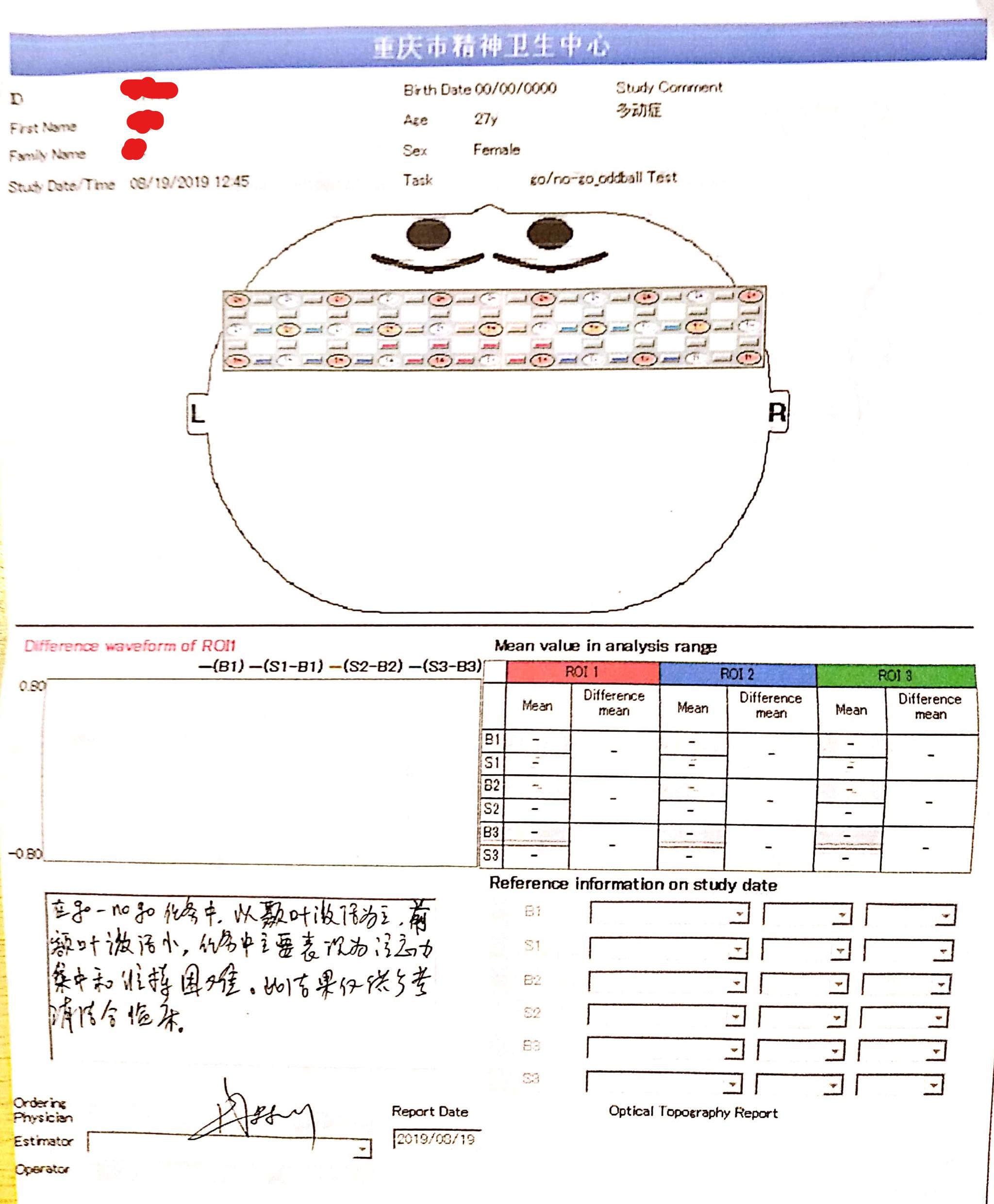 陈盈的脑电图显示前额叶激活小,注意力集中和衔接困难.
