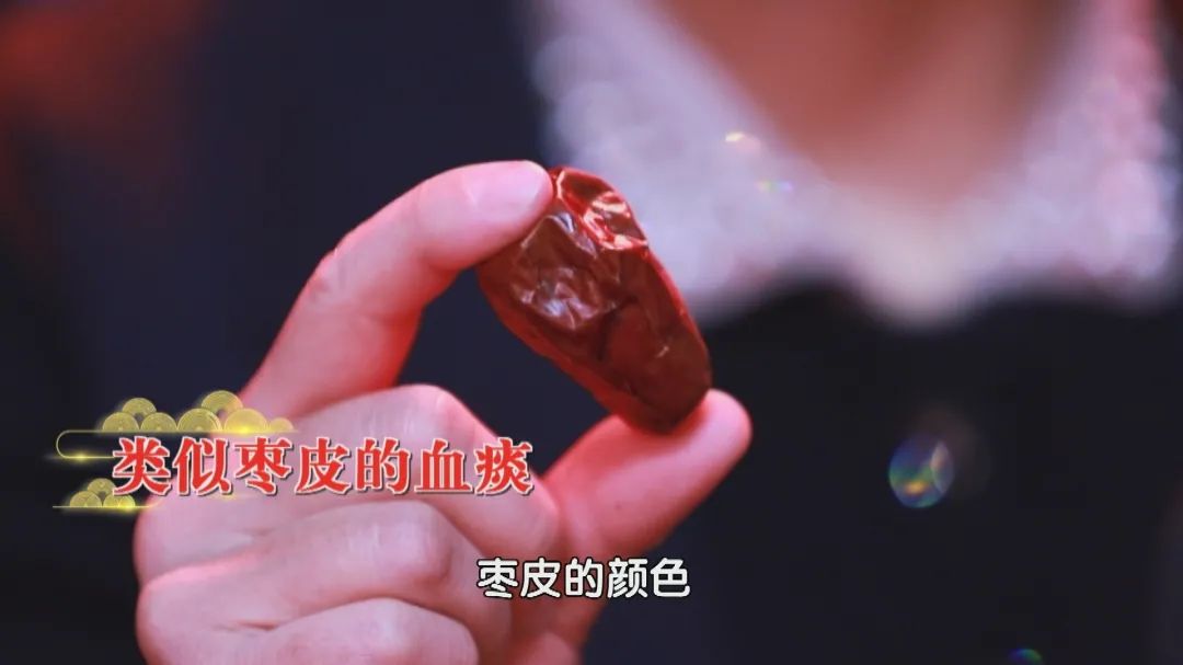 有时候鲜红,有时候暗红,量大的时候可以变成血痰或者脓血痰,对于支