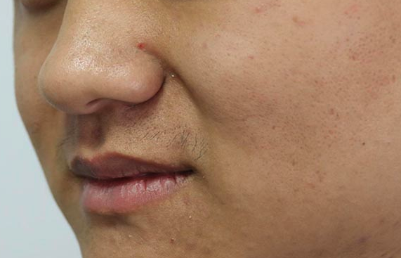 皮肤发黄怎么调理?皮肤主任建议多吃4种食物