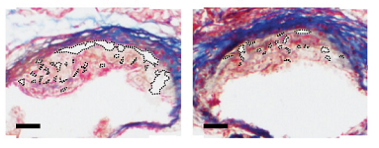 2020年十大健康领域创新榜单发布 这一癌症早筛技术入选