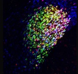发现大脑的疼痛中枢。