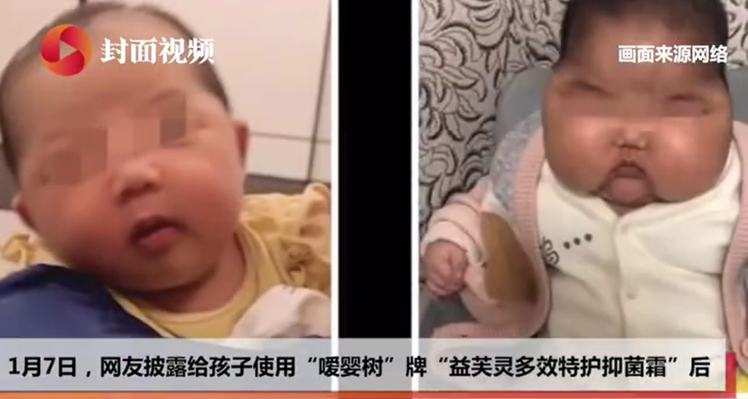 母婴周刊：“大头娃娃”事件后 消字号护肤品该如何管？