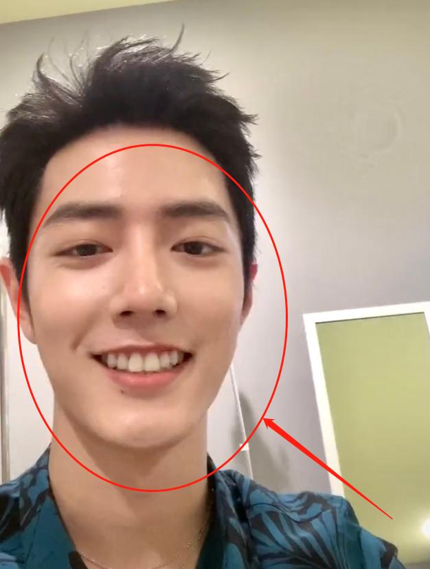 肖战用大嘴特效自拍,看清无美颜下的皮肤状态,果然有颜就是任性